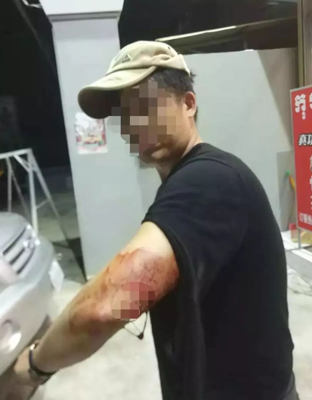 因财务纠纷 1中国男子遭合伙人砍伤-1.jpg