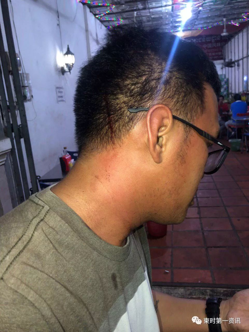 中国烧烤店内，女星及同伙殴打一男子致头部受伤-6.jpg