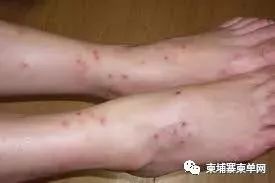 小伙从柬埔寨回国入关就被隔离！关于登革热你必须知道...-6.jpg