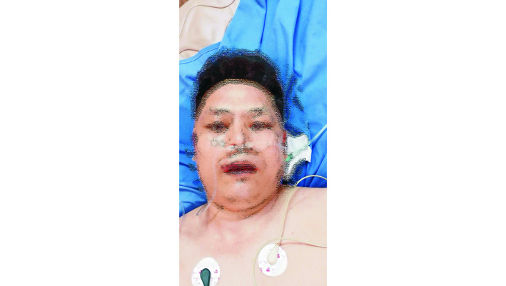 中国男子遭遇严重车祸 任职厂家不闻不问-1.jpg