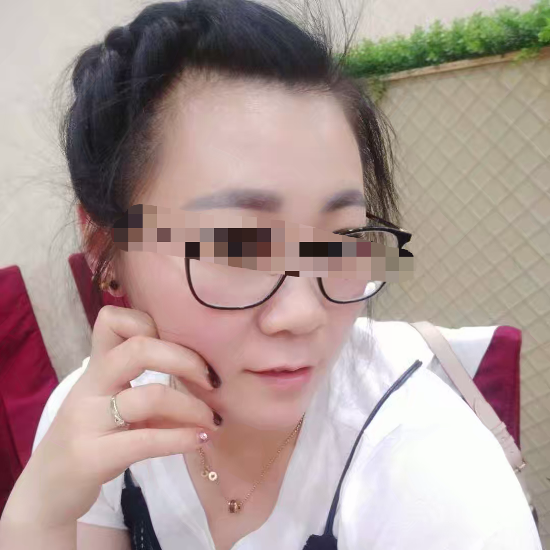 063340rbbw8wbb83m72var.png