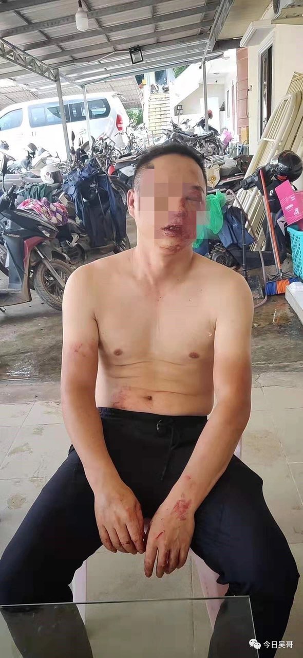 小伙双狮旁遭群殴，还被持枪威胁？这是怎么回事？-1.jpg