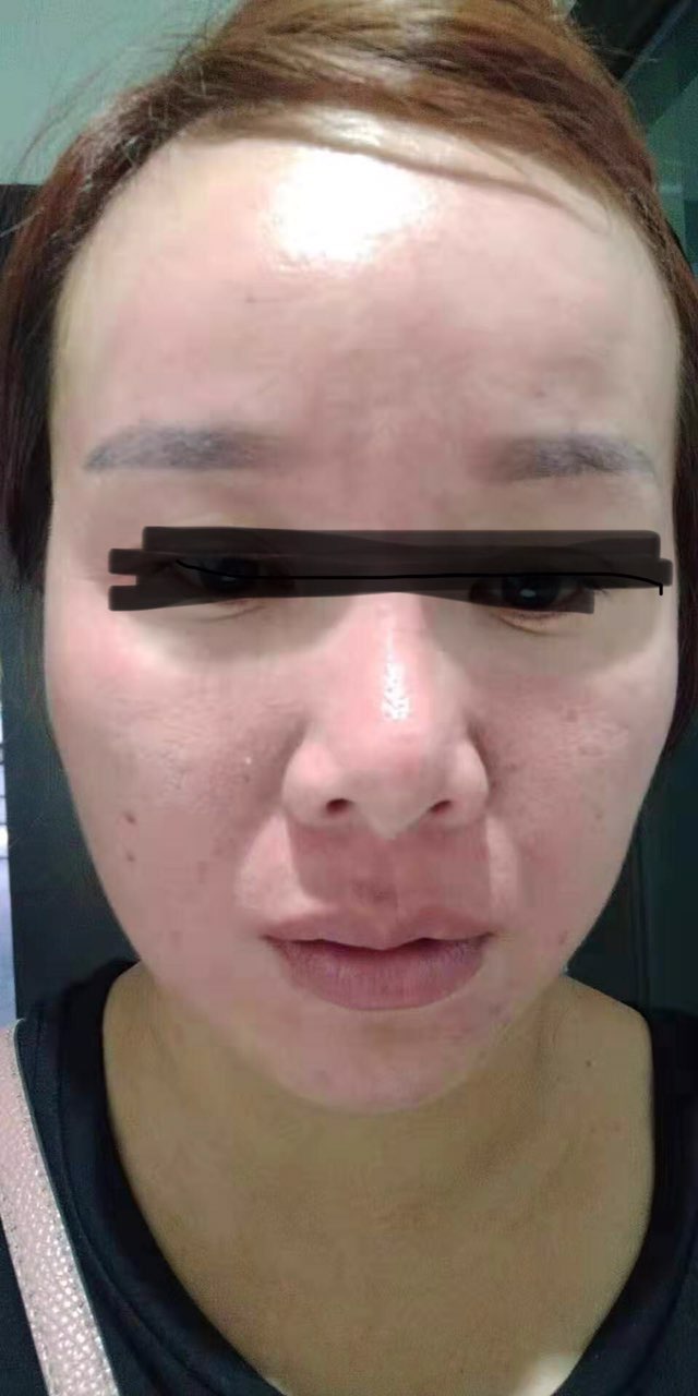 一个孤苦的女人在西港打拼，用了买来的面膜缺换来毁容，该如何维权？-1.jpg