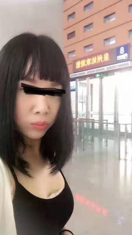 一个孤苦的女人在西港打拼，用了买来的面膜缺换来毁容，该如何维权？-2.jpg