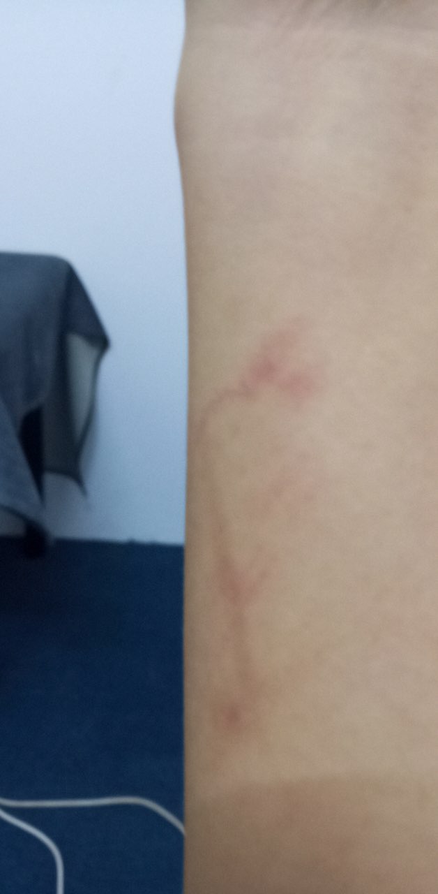 一个孤苦的女人在西港打拼，用了买来的面膜缺换来毁容，该如何维权？-4.jpg