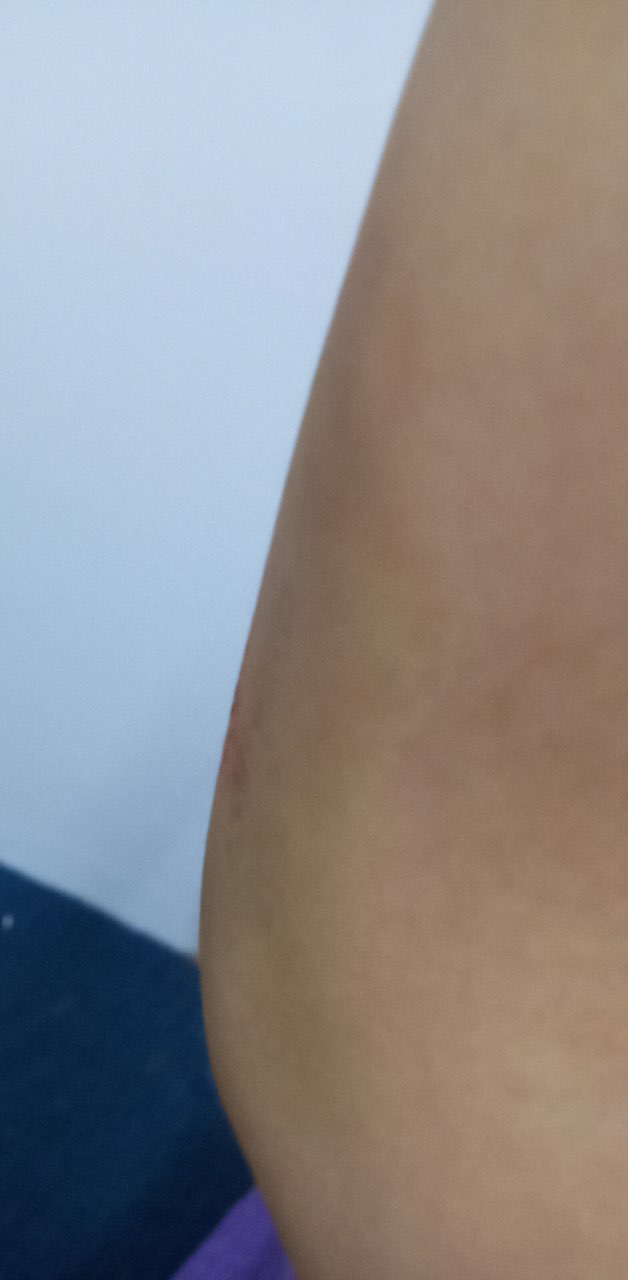 一个孤苦的女人在西港打拼，用了买来的面膜缺换来毁容，该如何维权？-5.jpg