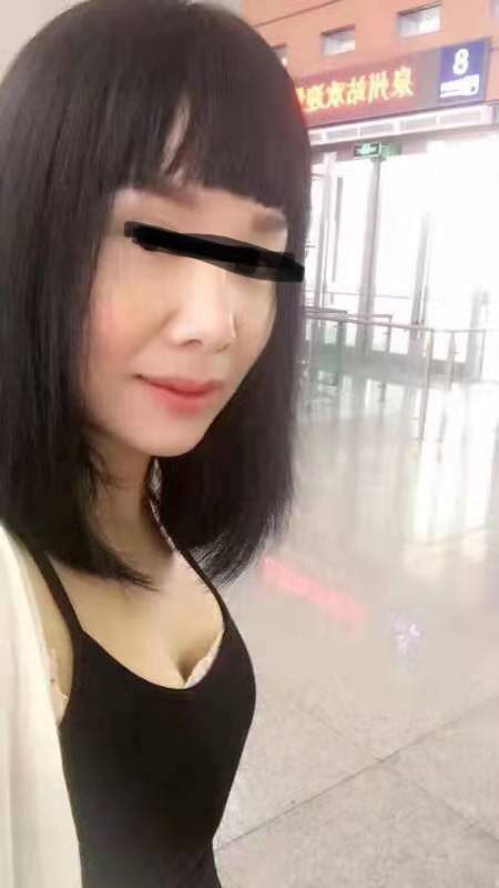 一个孤苦的女人在西港打拼，用了买来的面膜缺换来毁容，该如何维权？-3.jpg