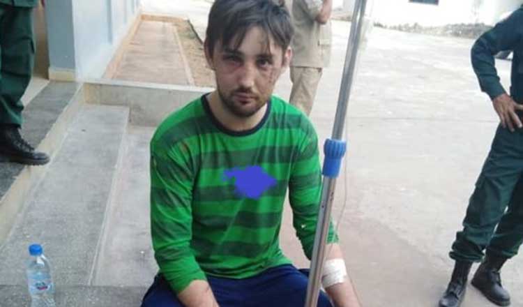russian-beaten.jpg