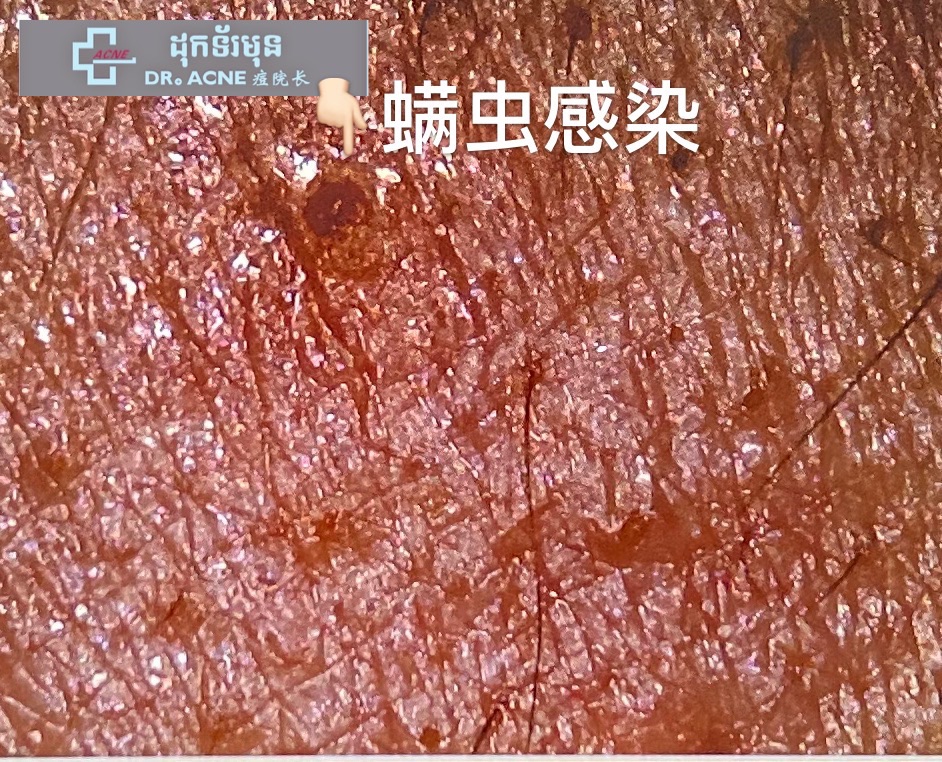 FhPgVQx9Iiu1fxflIltg6Zp5mn2i.jpg