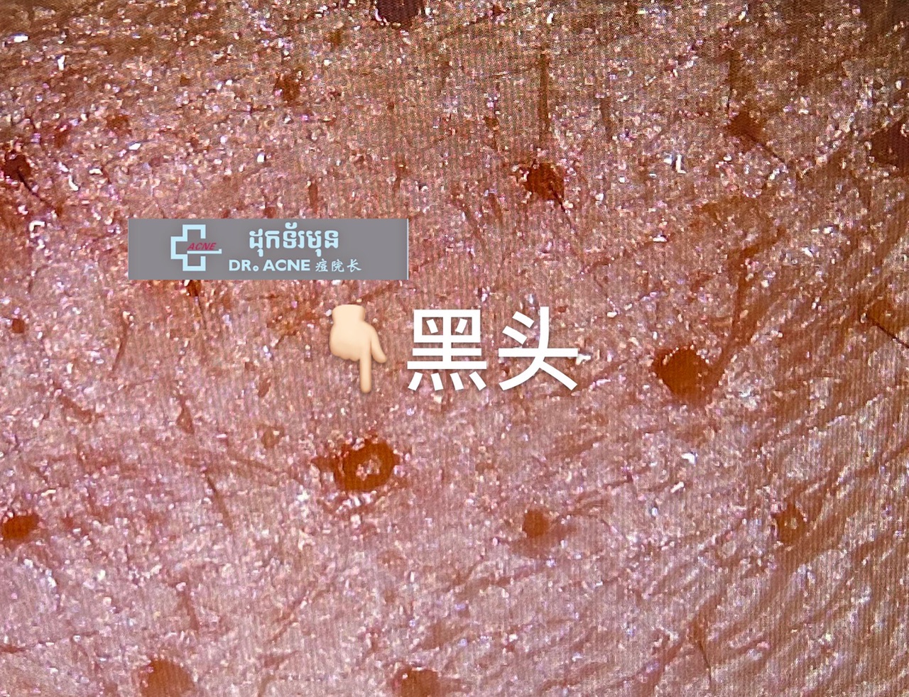 FjB80PnDRAXB5WXslaJ35OuwPav3.jpg