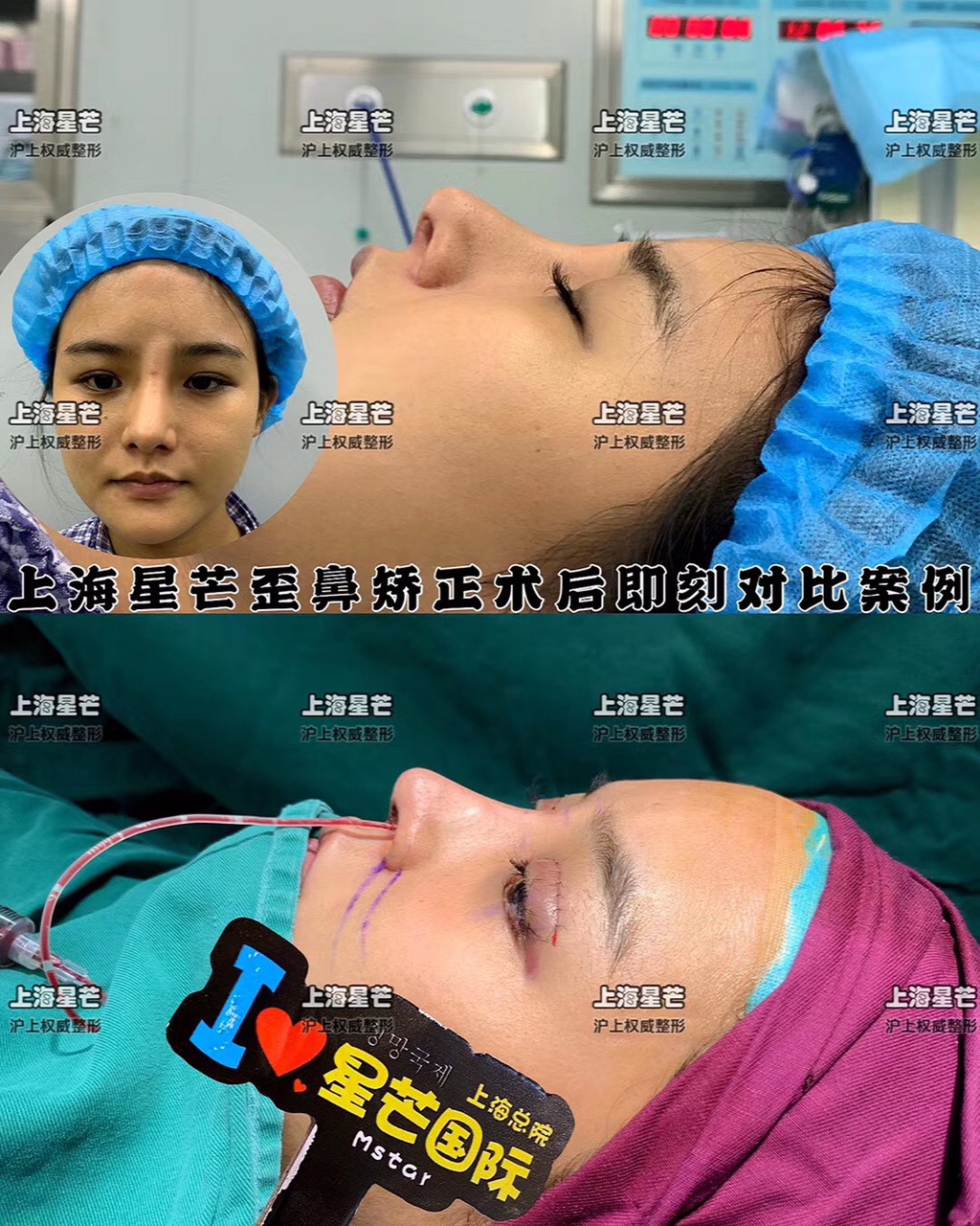 front1_FuKuKwKdWcgoFQjg1HsCt_M2hkeD.jpg