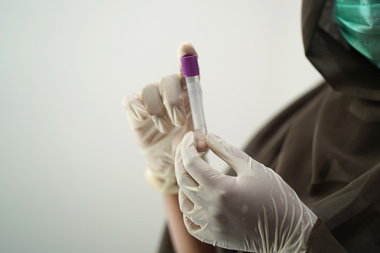 blood-test-5601437_1280.jpg