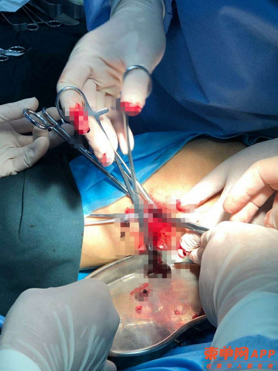 093211inbhncmh2jph2ph2.jpg