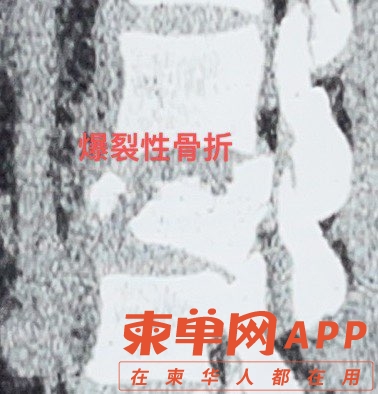 20220119134259front1_0_370097_Fh_cc1l75TqDHNTQspjw5BJJyxYG.jpg