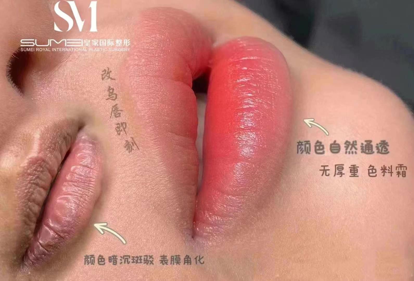 20221211140019front1_0_483855_Fhtfg_hkG__2nQbgdrtRY7M7aRBp.jpg