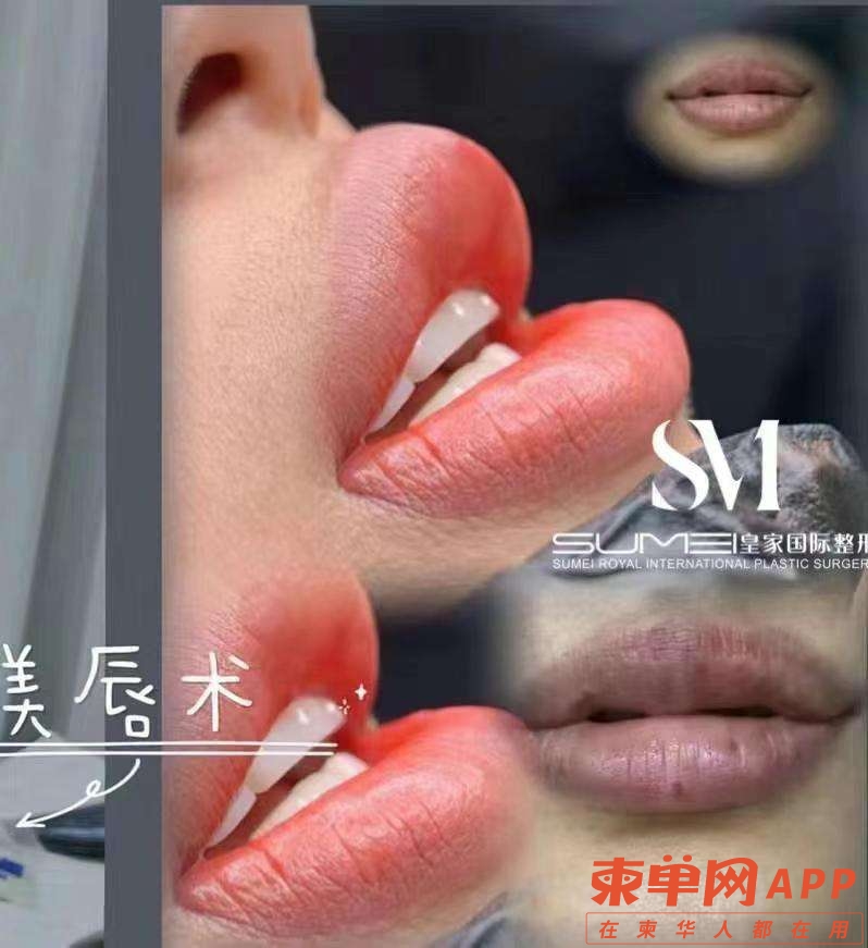 20221211152453front2_0_431197_Fu1_suPK39o2jLTlLt5N6vivhgMW.jpg
