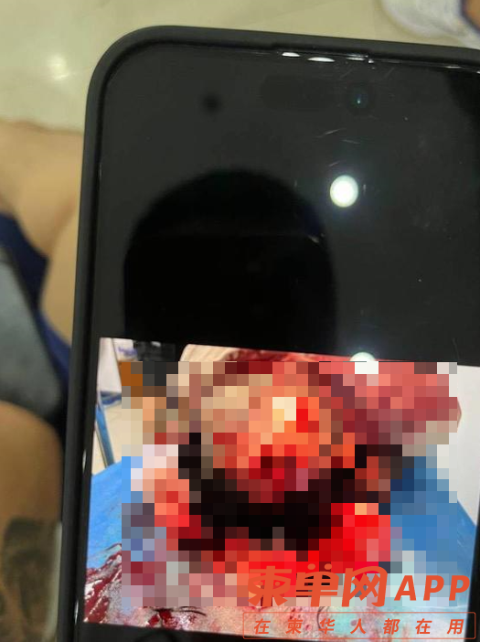 002.png