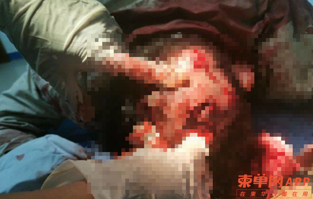 001.png