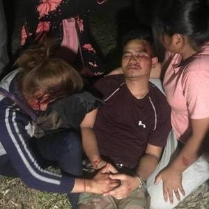 2骑士被撞重伤