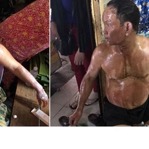 小煤气罐爆炸